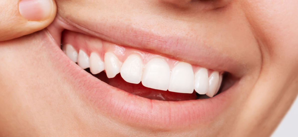 Как развивался плазмолифтинг в стоматологии